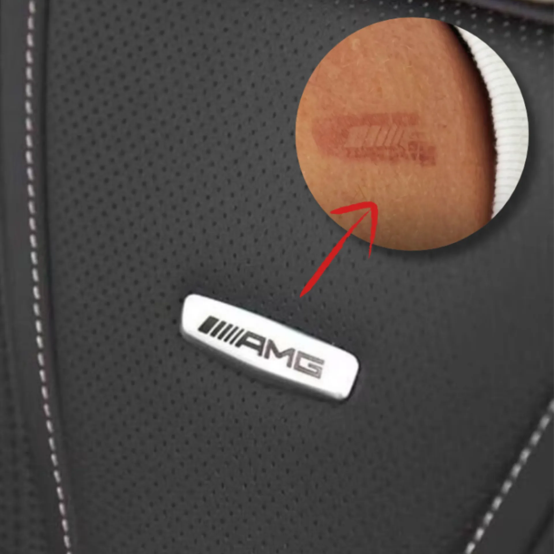 메르세데스-AMG 시트 로고 설계 결함 및 화상 피해 논란